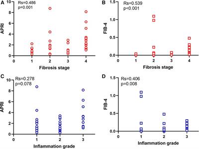 FIB-4 and APRI scores for progressive liver fibrosis diagnosis in children with biliary atresia